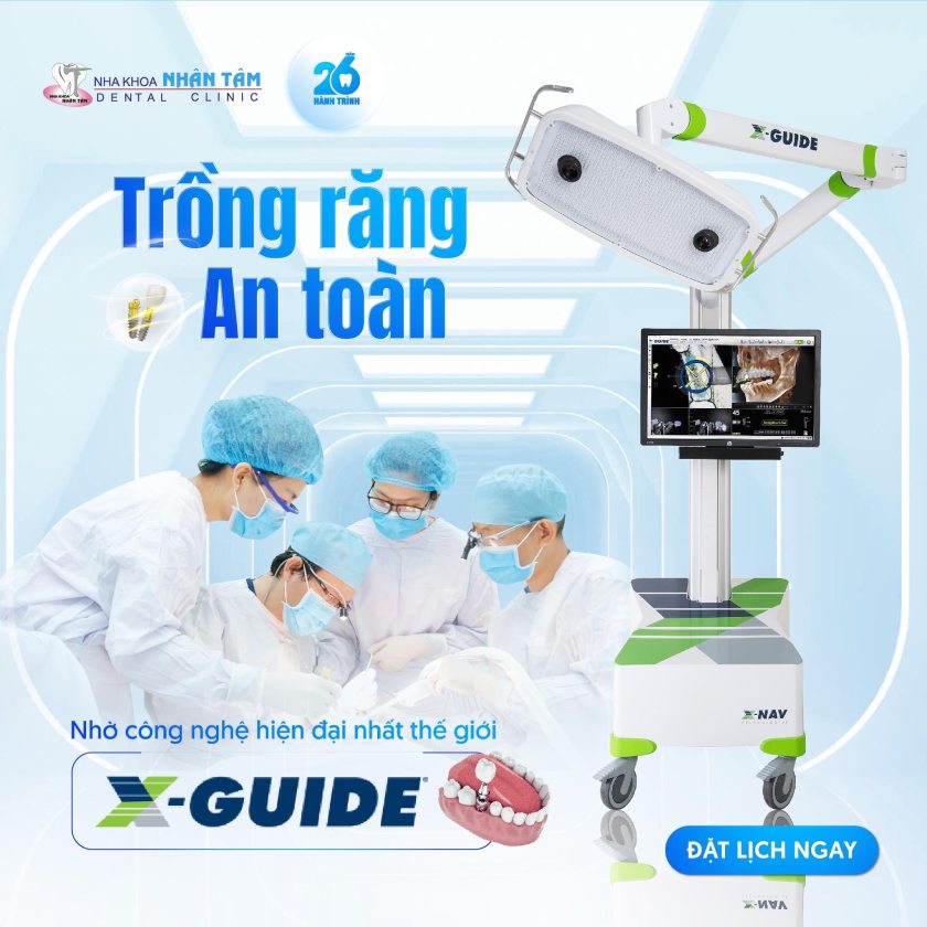 Trồng răng an toàn với hệ thống định vị X-Guide