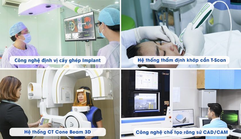 Trung tâm Implant Việt Nam tiên phong ứng dụng hệ thống công nghệ hiện đại trong trồng răng Implant