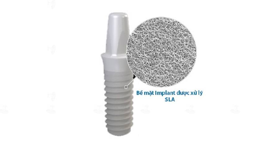 Bề mặt trụ Implant Dentium Superline được xử lý bằng công nghệ SLA