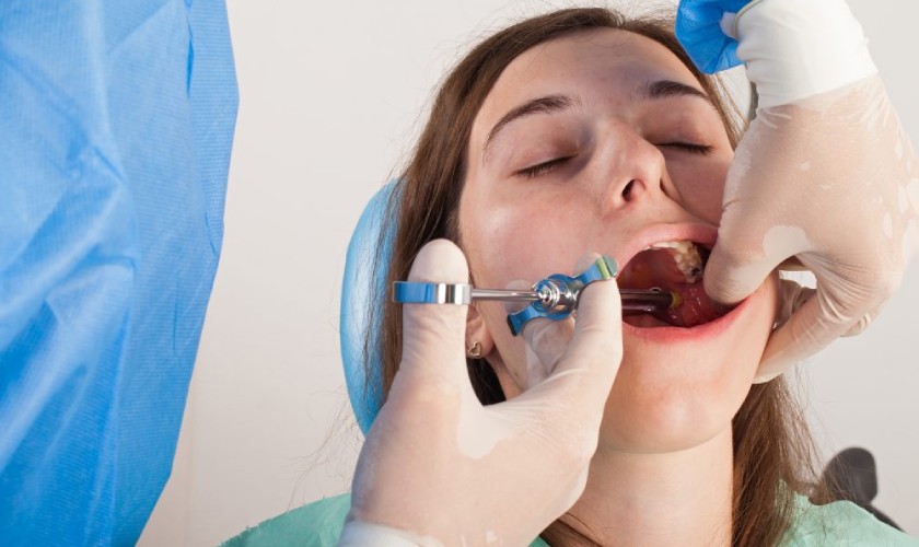 Hiệu quả tê là một trong những yếu tố quyết định trồng răng không đau