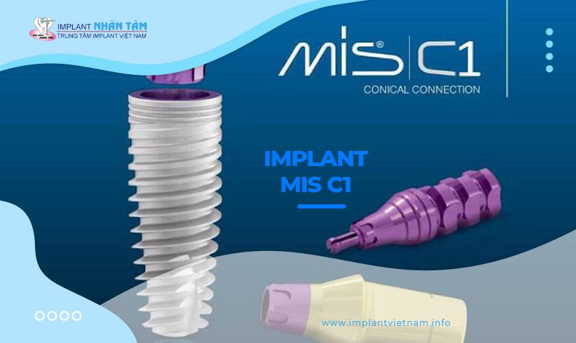 Tìm hiểu cấu tạo, ưu điểm, trường hợp nên cấy Implant MIS C1