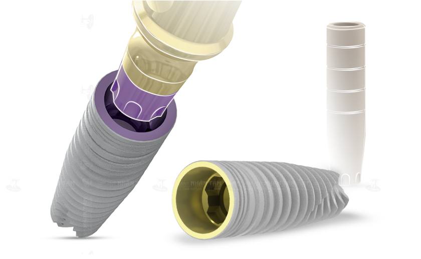 Trụ Implant MIS C1 là dòng trụ Implant chất lượng cao của Đức