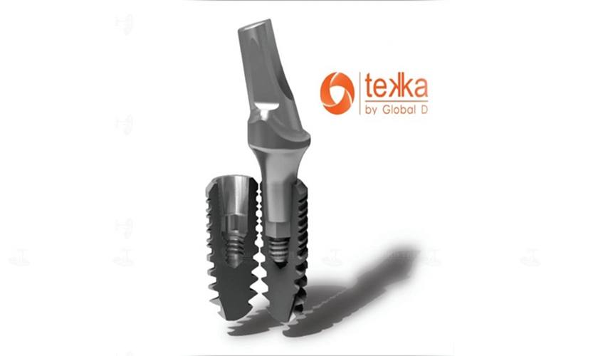 Implant Tekka đến từ Pháp