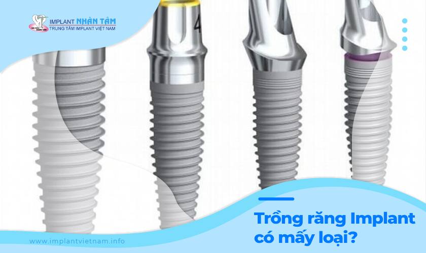 Trồng răng Implant có mấy loại và nên chọn loại nào?