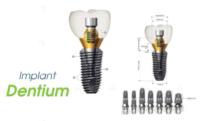 Trụ Implant Dentium - Hàn Quốc