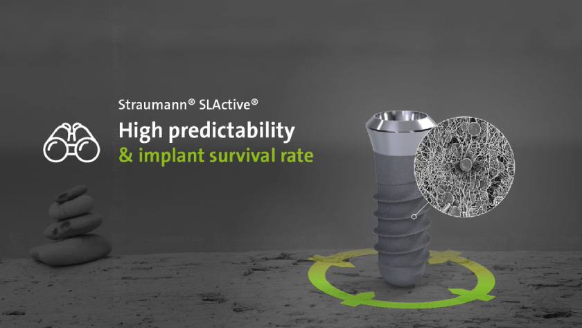 Trụ Implant Straumann sở hữu ưu điểm vượt trội