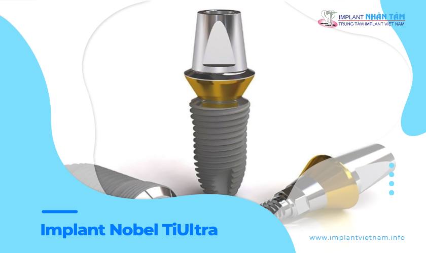 Trụ Implant Nobel TiUltra: Xuất xứ, cấu tạo và chi phí