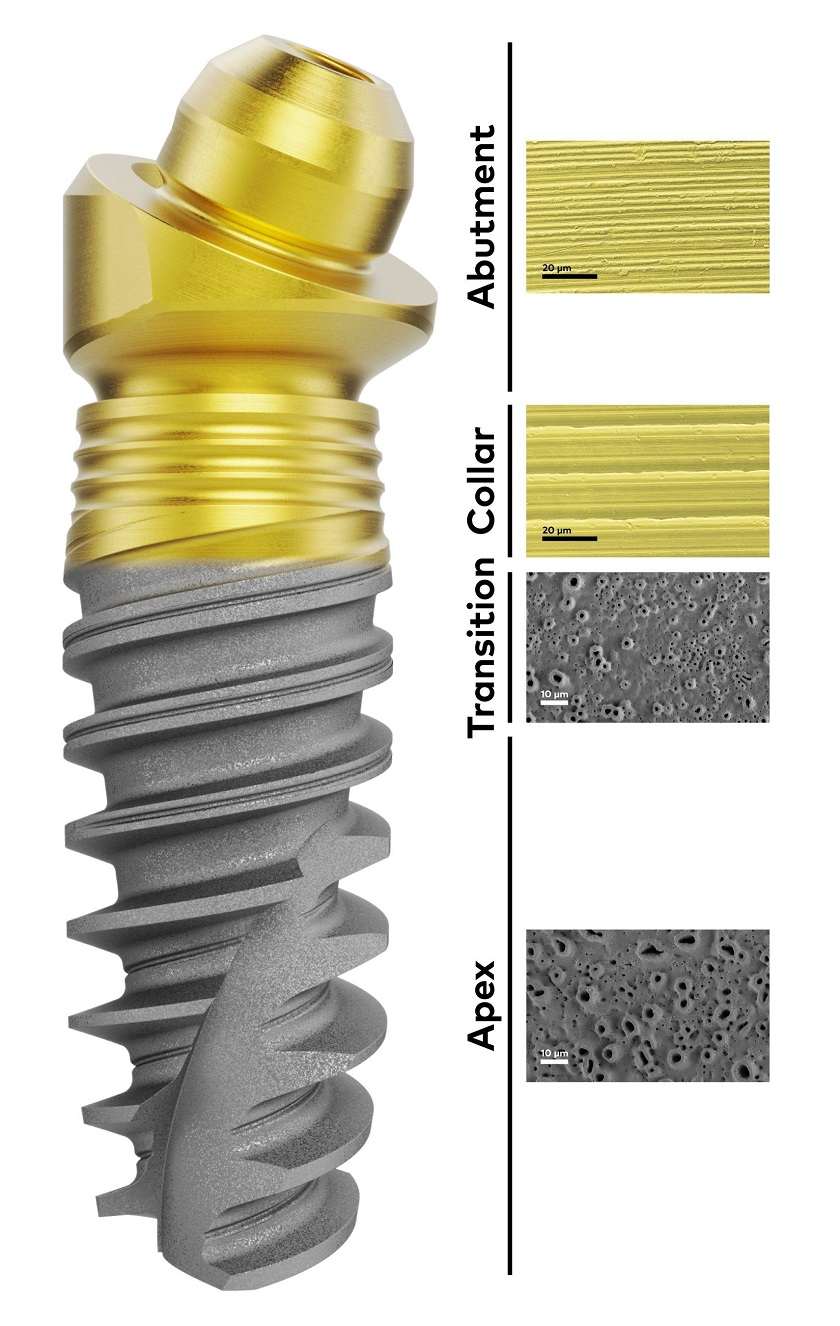 Implant Nobel phù hợp với nhiều trường hợp mất răng từ đơn giản đến phức tạp