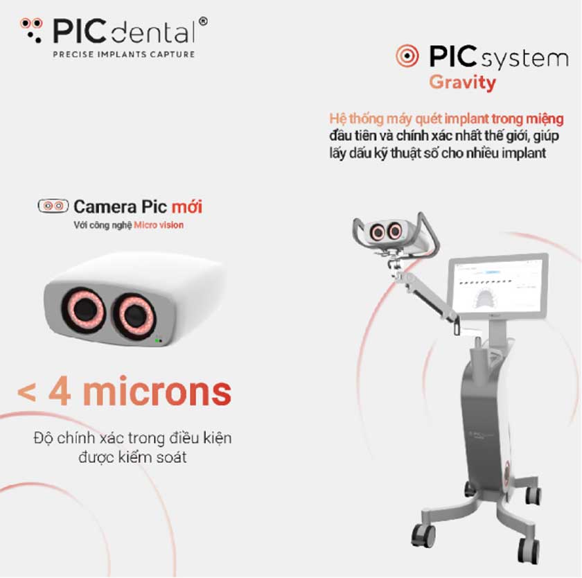 Công nghệ PIC trong trồng răng Implant cho phép xác định tọa độ Implant một cách chính xác và an toàn