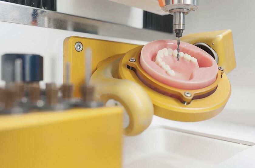 Phục hình răng với công nghệ CAD/CAM chính xác, khít sát chân răng