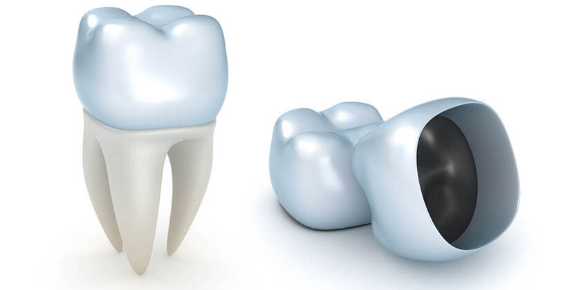 CAD/CAM cho ra đời những chiếc răng sứ có kích thước và màu sắc hài hòa