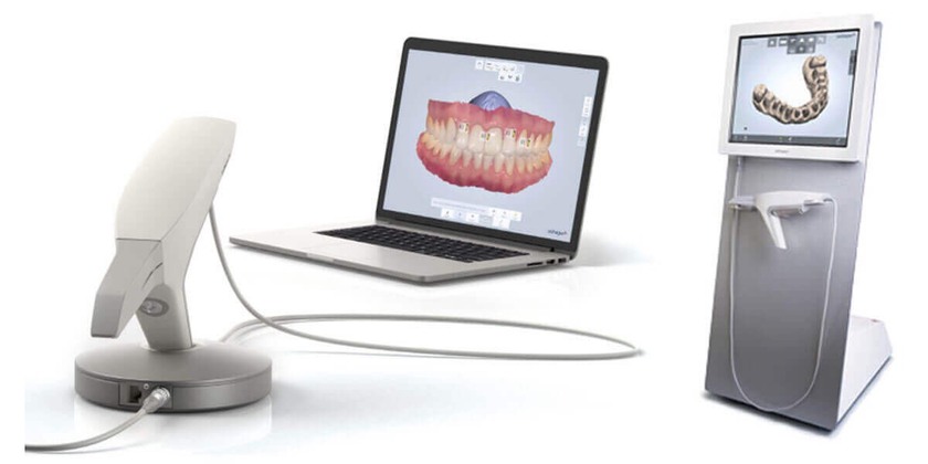 Lấy dấu răng gián tiếp với công nghệ Scan 3D khắc phục những hạn chế của phương pháp thủ công