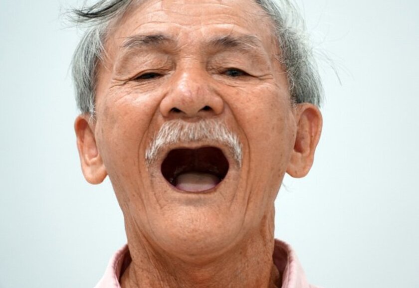Người lớn tuổi thường gặp tình trạng mất răng do loãng xương, thiếu canxi