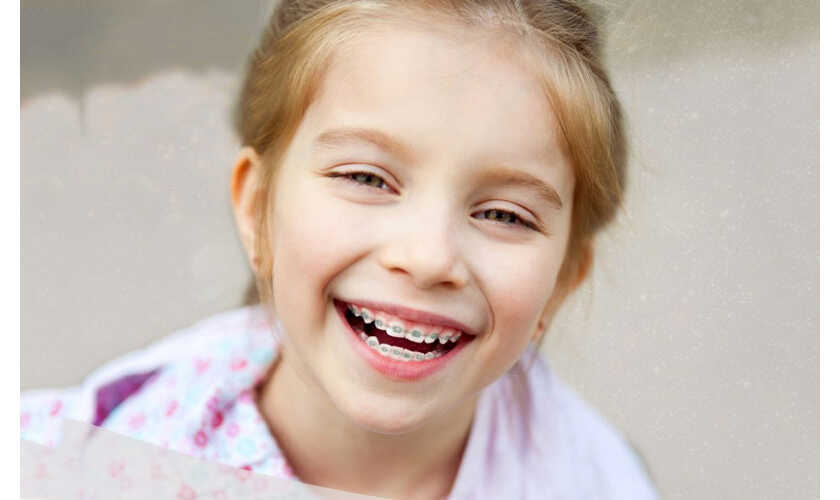 Đối với răng mọc ngược ở trẻ em, bác sĩ thường sẽ chỉ định niềng răng