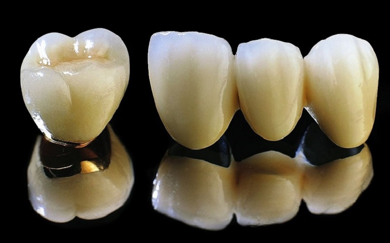 Răng sứ titan có bị đen không? Chăm sóc răng sứ titan thế nào?