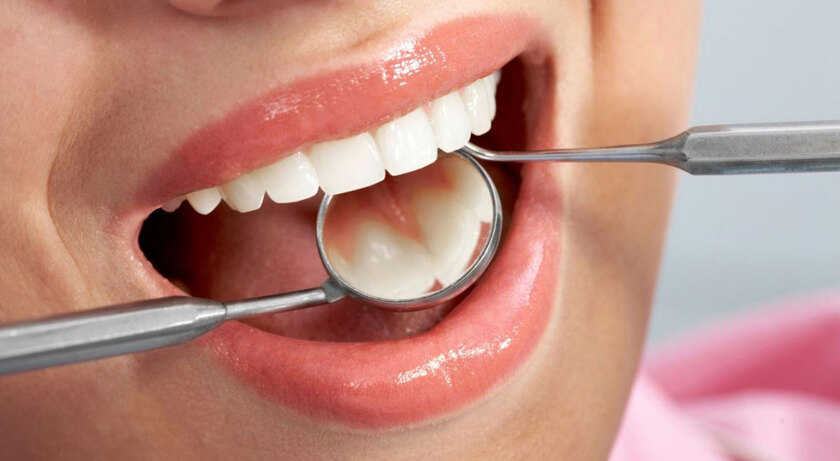 Cách vệ sinh răng sứ titan của khách hàng cũng rất quan trọng