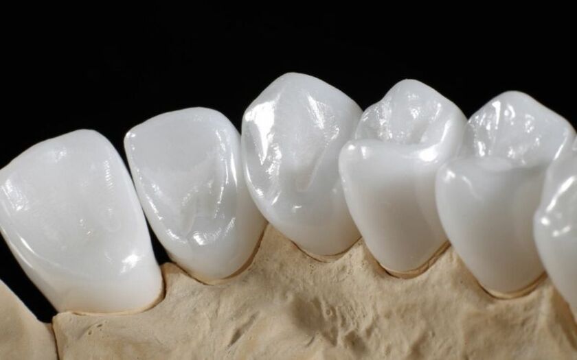 Giá bọc răng sứ Zirconia dao động từ 5.000.000 10.000.000đ/răng