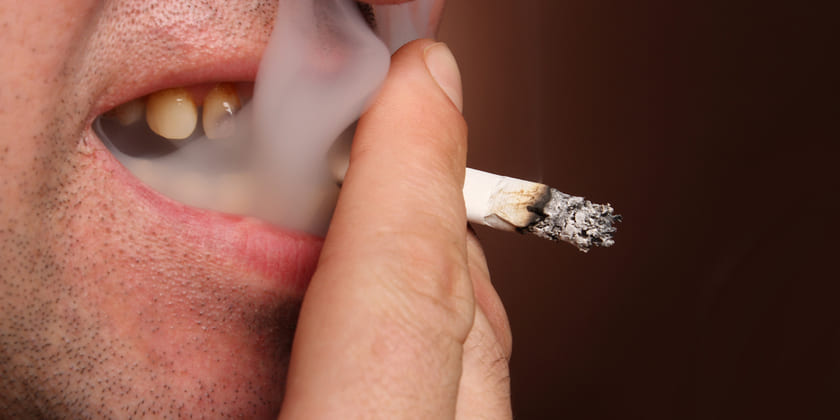 Thói quen hút thuốc lá tăng nguy cơ mất răng