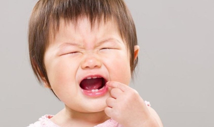 Sưng mộng răng ở trẻ em và cách khắc phục hiệu quả an toàn