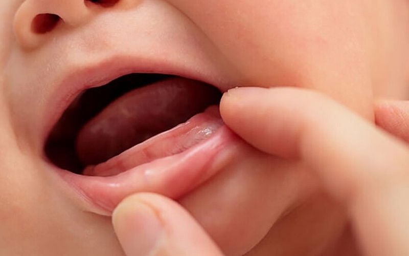 Trẻ chậm mọc răng do đâu? Có ảnh hưởng như nào đến trẻ?