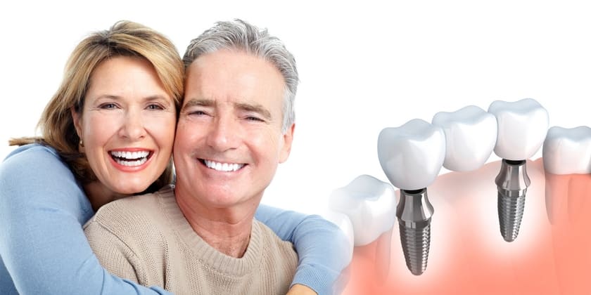 Trồng răng implant cho người lớn tuổi được các chuyên gia khuyên dùng