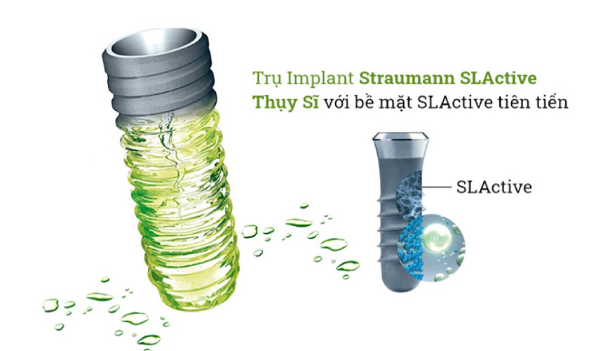 Trụ Implant Straumann Thụy Sỹ