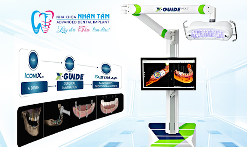 Ứng dụng phần mềm Fastmap với công nghệ định vị X-Guide NXT