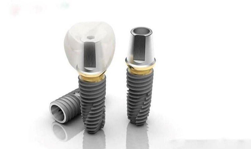 Tất cả răng sứ và trụ Implant sử dụng tại Nha khoa Nhân Tâm đều là sản phẩm chính hãng