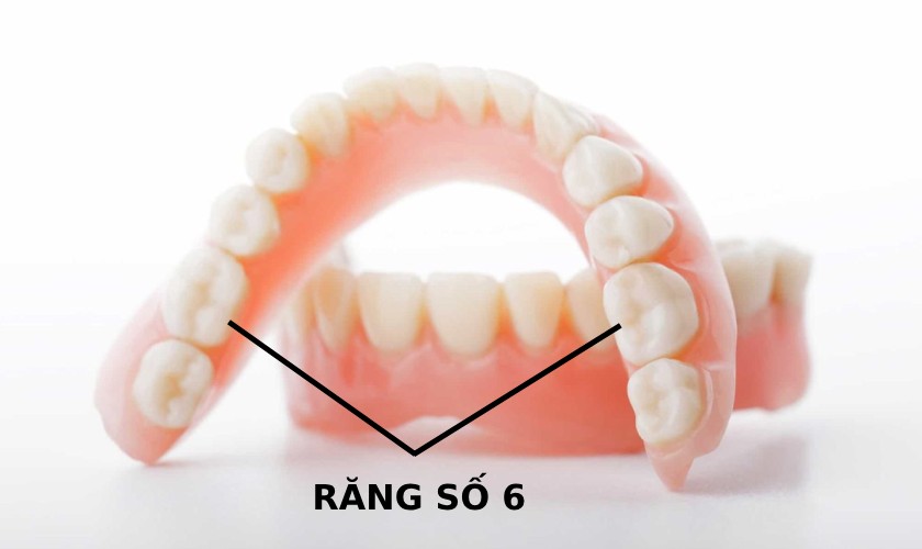 Răng số 6 chỉ mọc 1 lần duy nhất