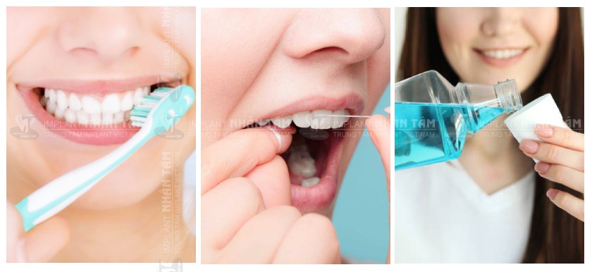Chăm sóc răng miệng đúng cách là cách loại bỏ tình trạng sưng lợi