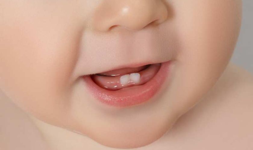 Trẻ mọc răng sẽ gây ra cảm giác đau nhức