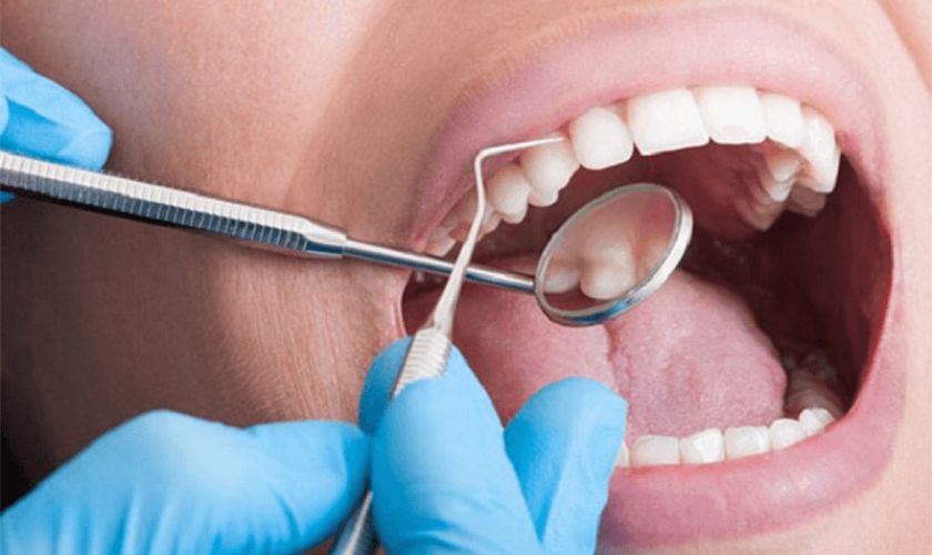 Thực hiện cạo vôi răng và thăm khám nha khoa định kỳ mỗi 6 tháng để loại bỏ các tác nhân gây bệnh lý răng miệng