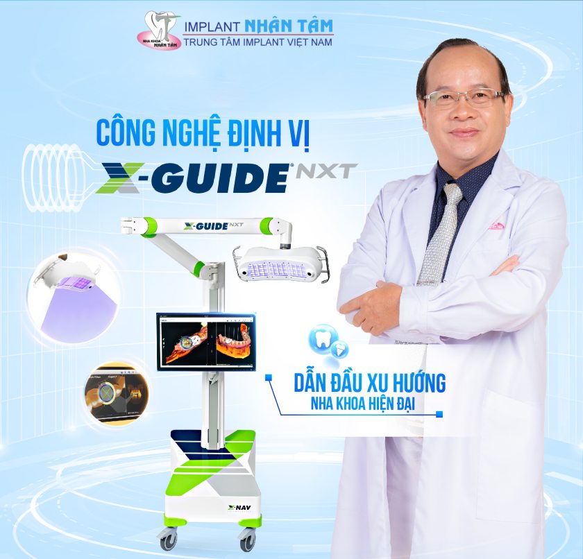 Công nghệ định vị X-Guide Công nghệ định vị X-Guide
