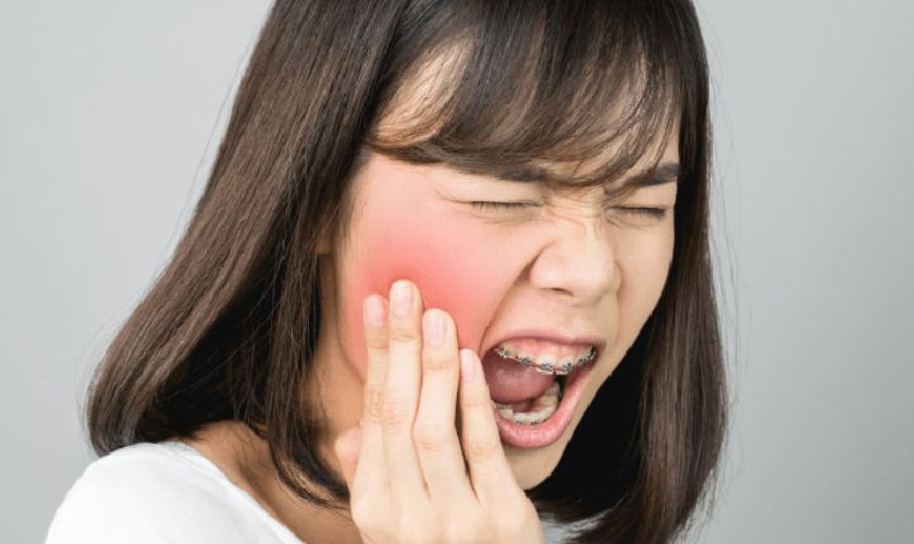 Đau răng sưng má bao lâu thì khỏi? 