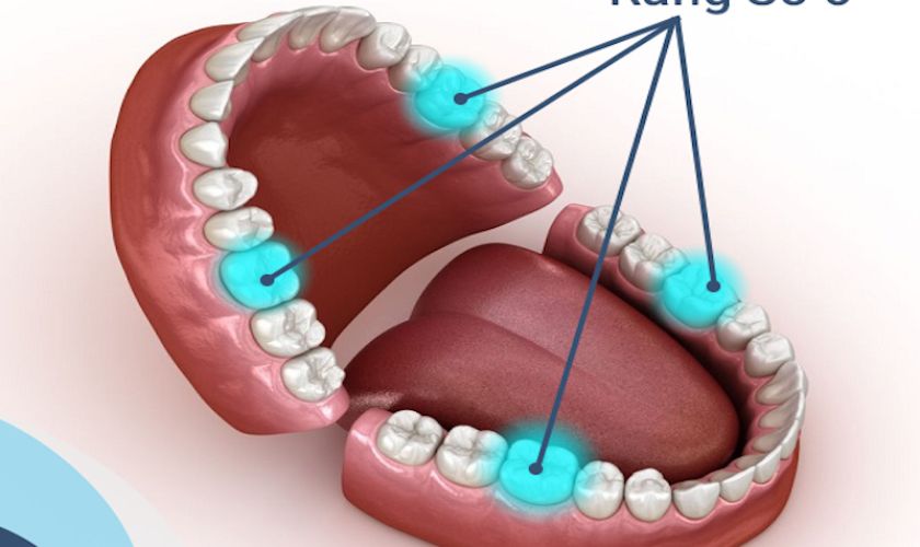 Đặc điểm của răng số 6