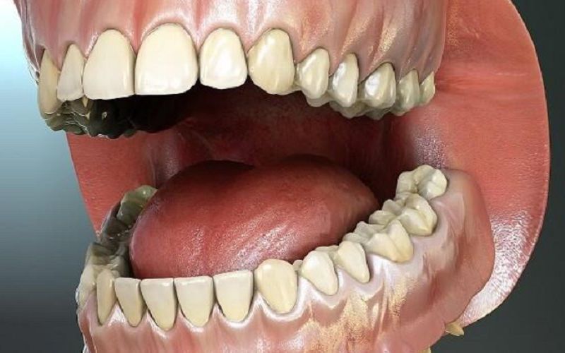 Cấu trúc tổng quan về hàm răng