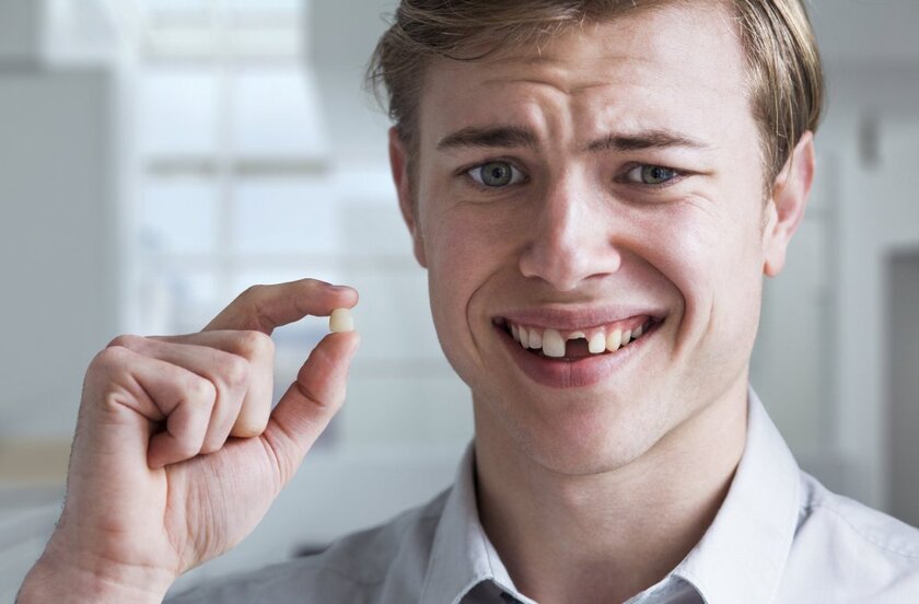 Mất răng cửa có thể do nhiều nguyên nhân cả chủ quan và khách quan