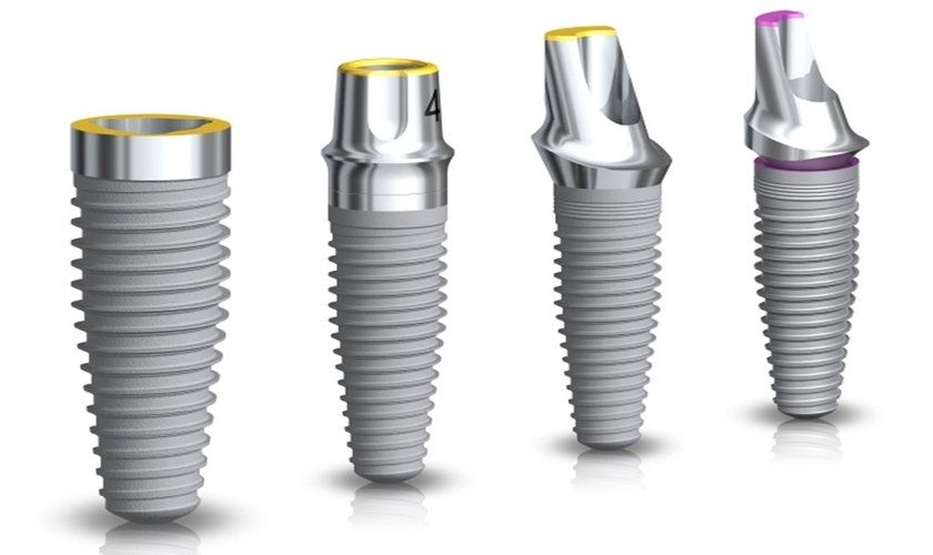 Kích thước trụ Implant không phù hợp có thể gây tình trạng răng sứ trên Implant bị vỡ