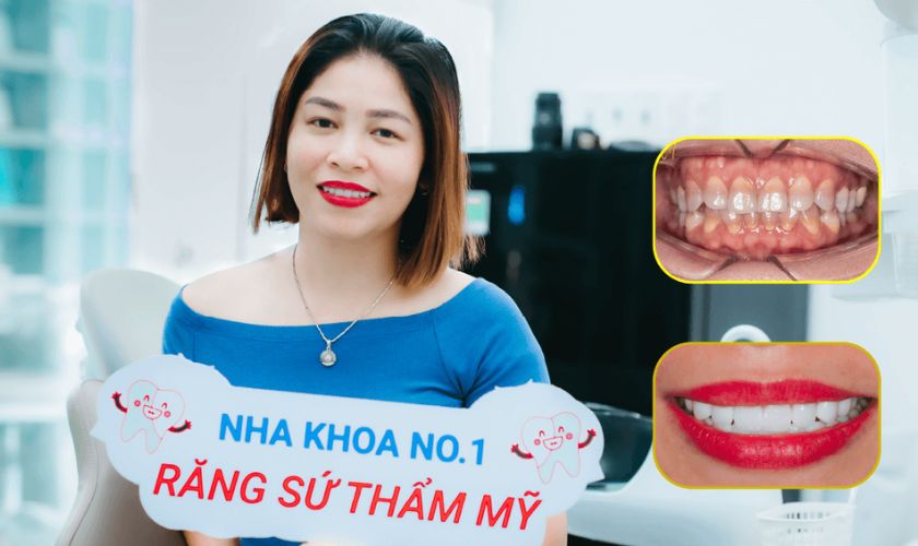 Khách hàng rất hài lòng khi sử dụng dịch vụ tại Nha khoa Răng Sứ No.1