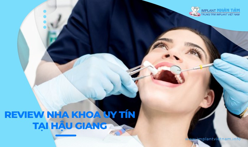 Review top 10 nha khoa uy tín tại Hậu Giang bạn nên ghé