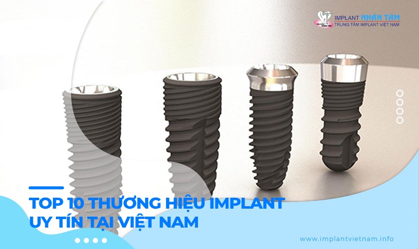 Top 10 thương hiệu Implant tại Việt Nam. Bạn đã biết chưa?