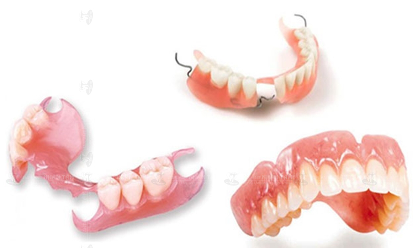 Hàm giả tháo lắp sử dụng một khung hàm bằng nhựa hoặc khung hợp kim, bên trên có gắn các răng giả bằng nhựa hoặc sứ để thay thế răng đã mất Hàm giả tháo lắp sử dụng một khung hàm bằng nhựa hoặc khung hợp kim, bên trên có gắn các răng giả bằng nhựa hoặc sứ để thay thế răng đã mất
