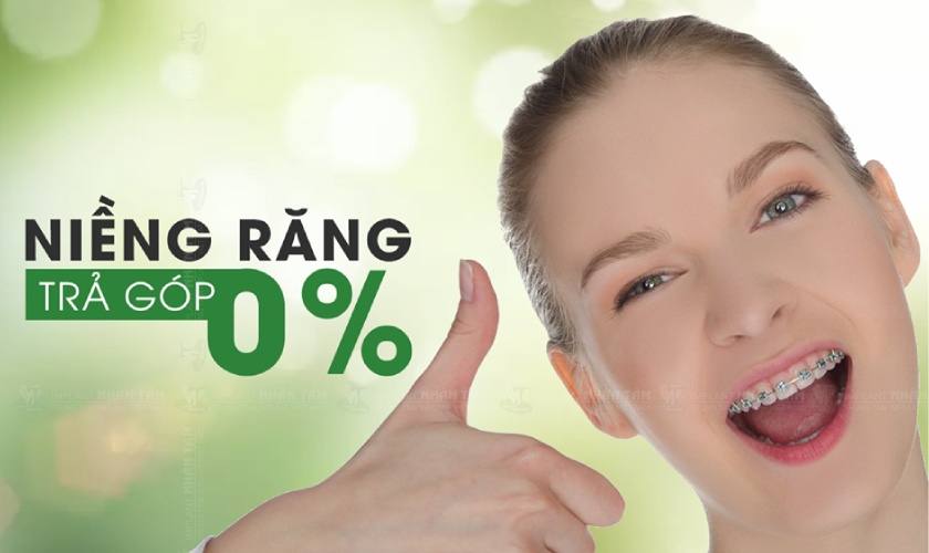 Dịch vụ niềng răng trả góp lãi suất 0%