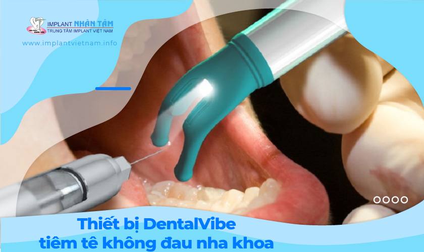 Giới thiệu thiết bị DentalVibe tiêm tê không đau nha khoa