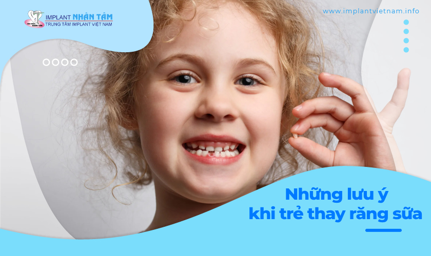 Những điều cần lưu ý khi trẻ thay răng sữa