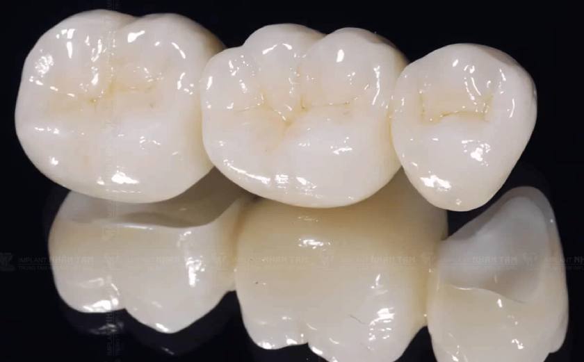 Răng sứ Zirconia là dòng răng sứ toàn sứ có khả năng chịu lực và chịu nhiệt cao