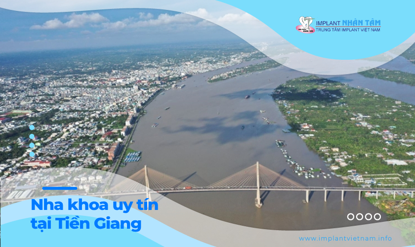 Review nha khoa uy tín tại Tiền Giang