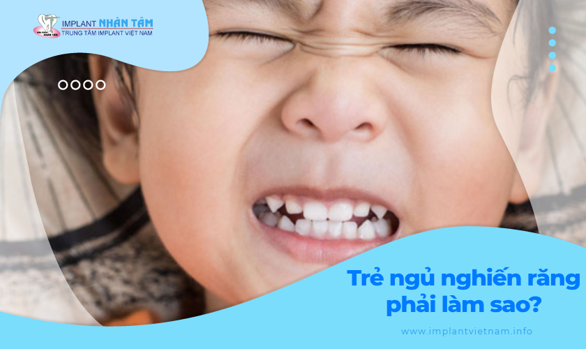 Trẻ ngủ nghiến răng phải làm sao?