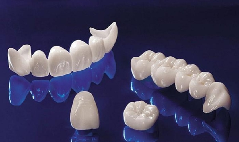 Răng sứ chất lượng cao giúp khách hàng khôi phục tối đa khả năng ăn nhai