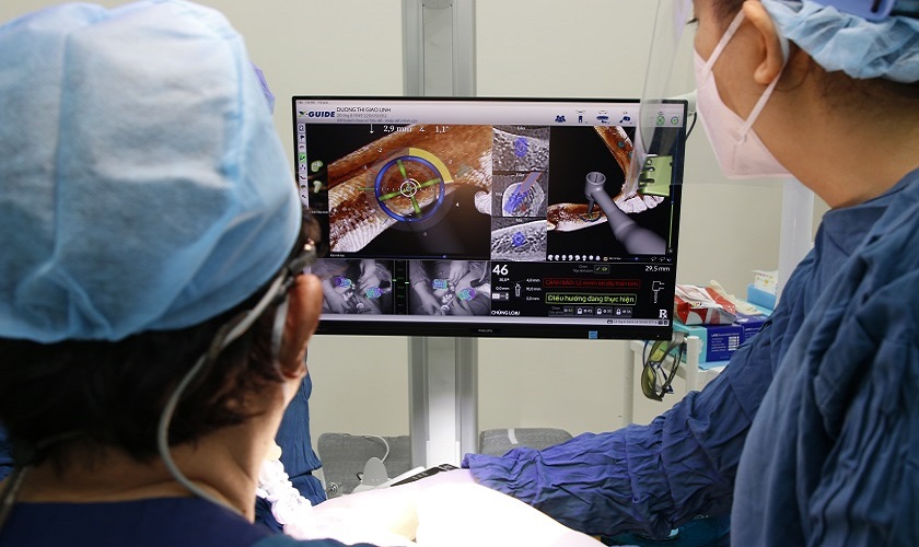 Cấy trụ Implant vào xương hàm với sự hỗ trợ của robot định vị tại Nha khoa Nhân Tâm